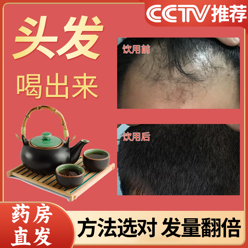 熟地黄精桑椹养血益精生发茶九晒九蒸九制中药材包正品官方旗舰店